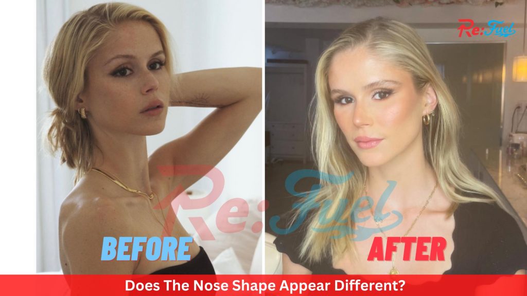 Did Erin Moriarty Get Plastic Surgery Done? Check Her Before and After Pics