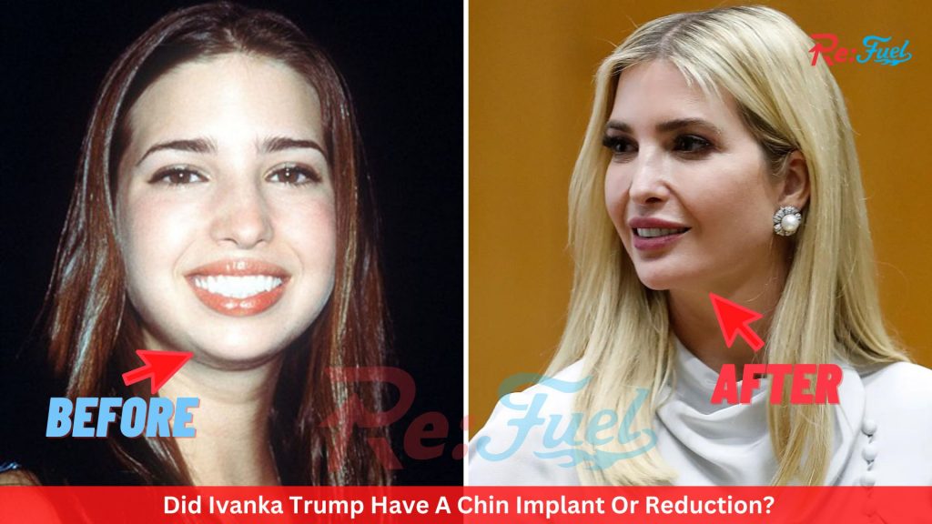 Ivanka Trump Before Plastic Surgery And After Pics - Analysis Of Her Cosmetic Surgeries