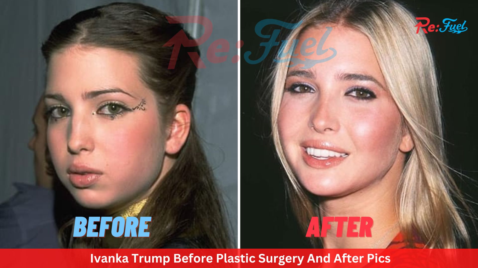 Ivanka Trump Before Plastic Surgery And After Pics