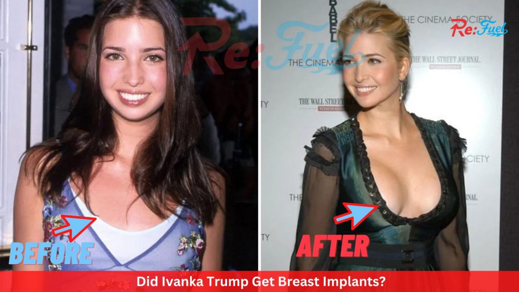 Did Ivanka Trump Get Breast Implants?