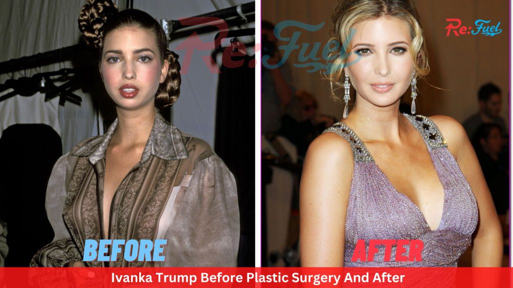 Ivanka Trump Before Plastic Surgery And After Pics - Analysis Of Her Cosmetic Surgeries
