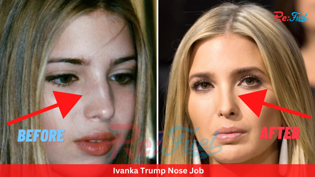 Did Ivanka Trump Get A Nose Job?
