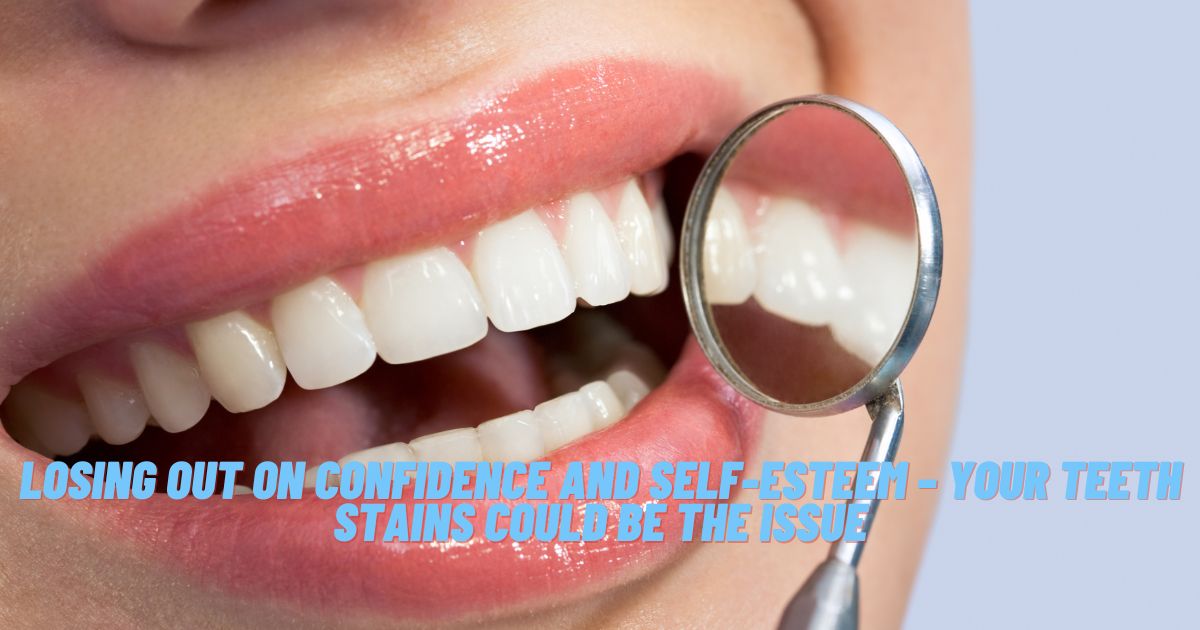 Losing Out on Confidence and Self-Esteem – Your Teeth Stains Could Be the Issue