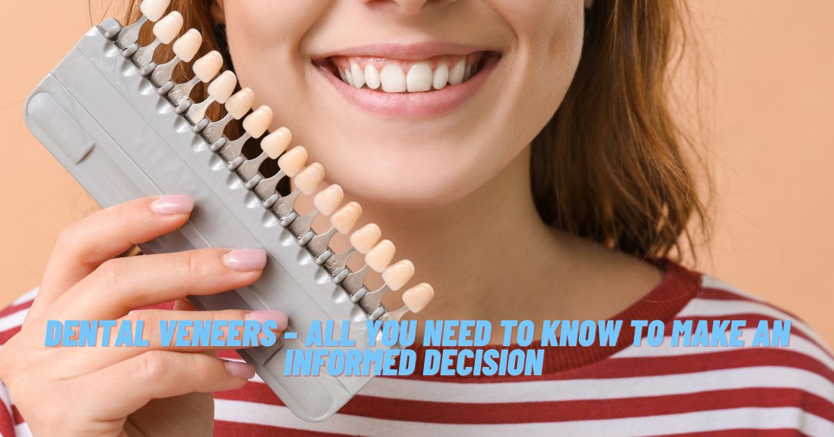 Dental Veneers – All You Need to Know to Make an Informed Decision