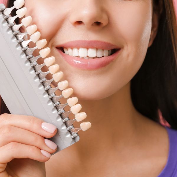 Dental Veneers – All You Need to Know to Make an Informed Decision 