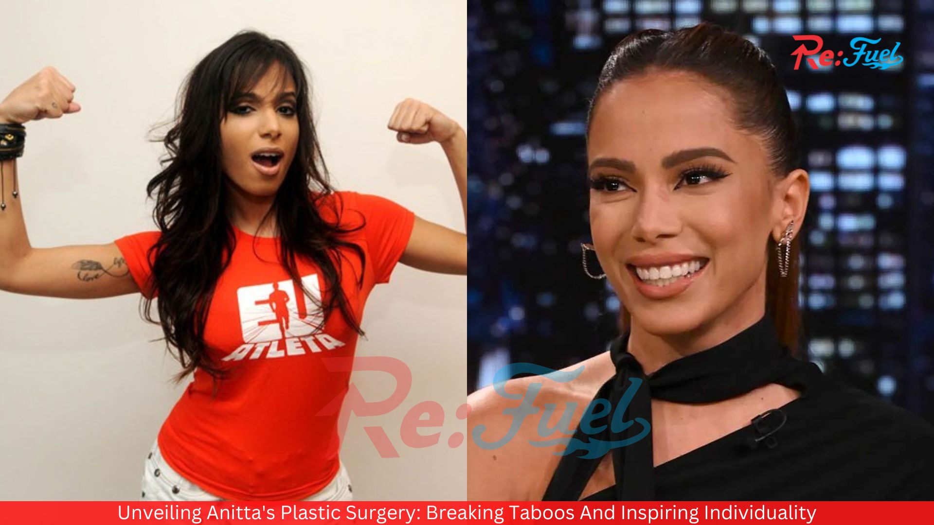 Unveiling Anitta's Plastic Surgery: Breaking Taboos And Inspiring Individuality