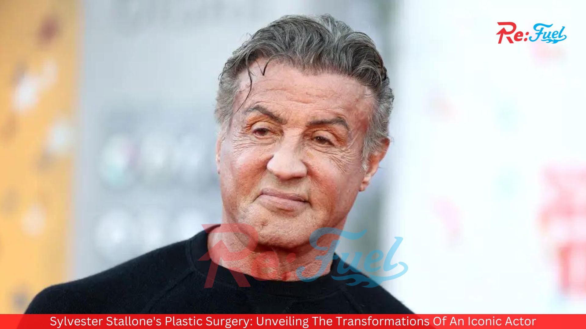 Sylvester Stallone's Plastic Surgery: Unveiling The Transformations Of An Iconic Actor
