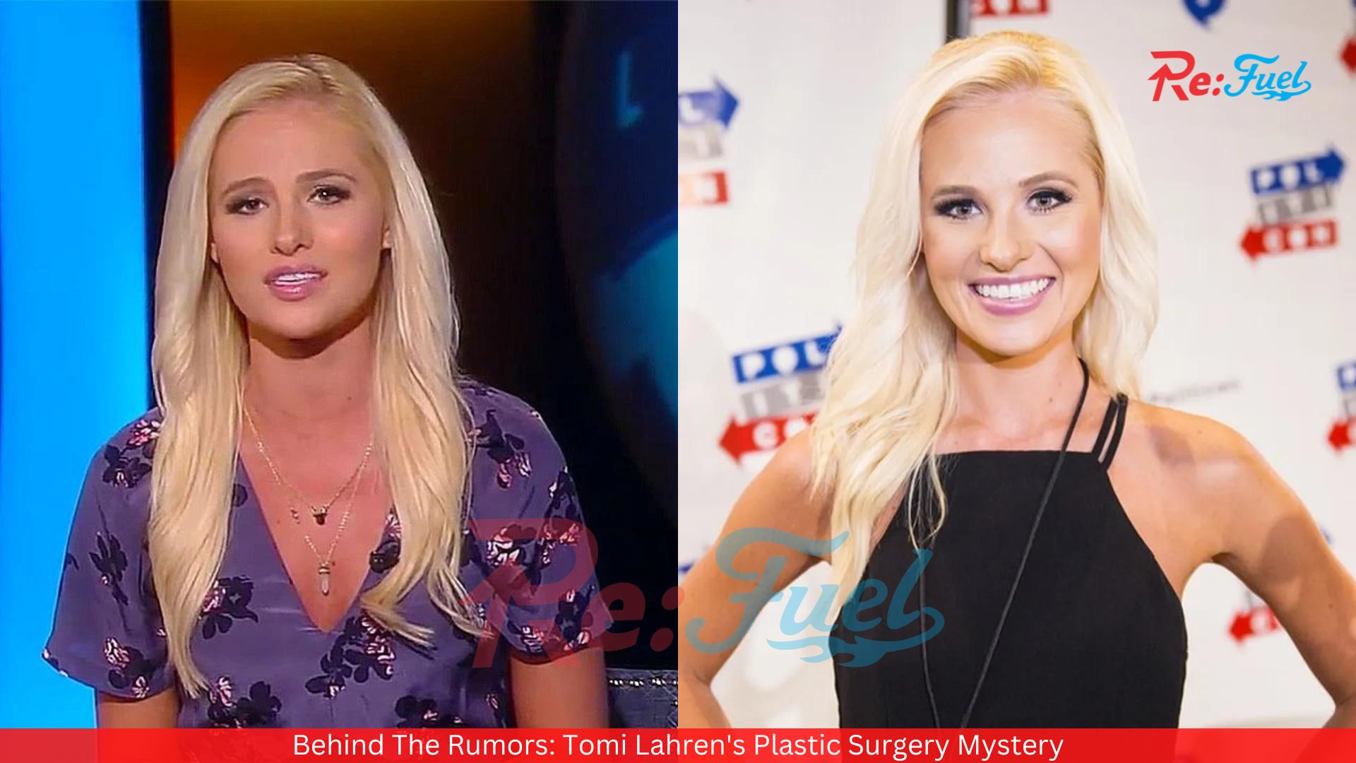 Behind The Rumors: Tomi Lahren's Plastic Surgery Mystery