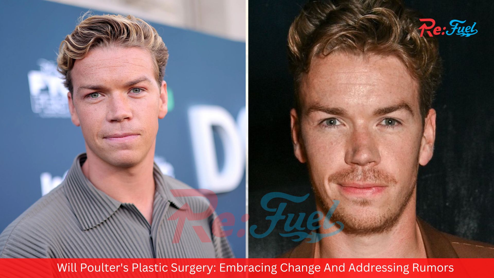 Will Poulter's Plastic Surgery: Embracing Change And Addressing Rumors
