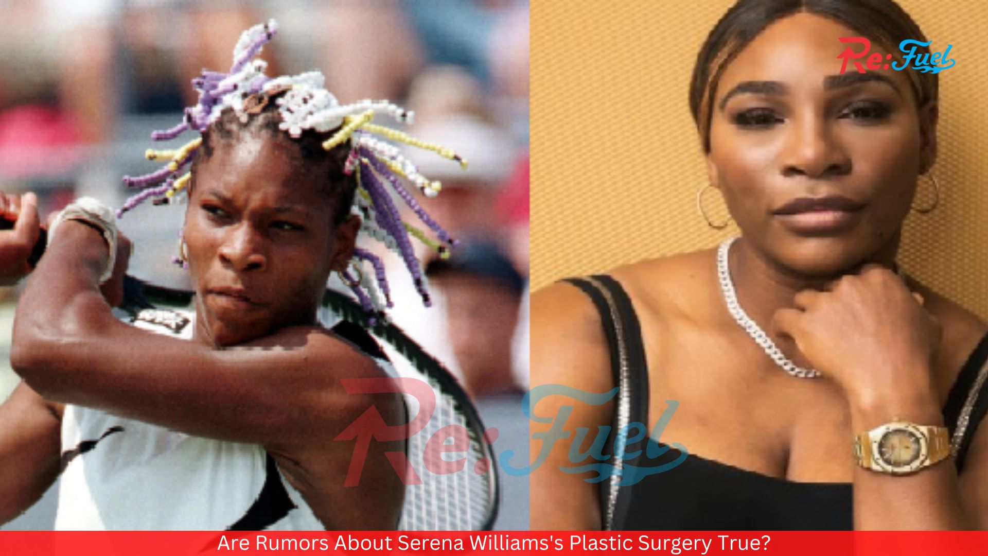 Are Rumors About Serena Williams's Plastic Surgery True?