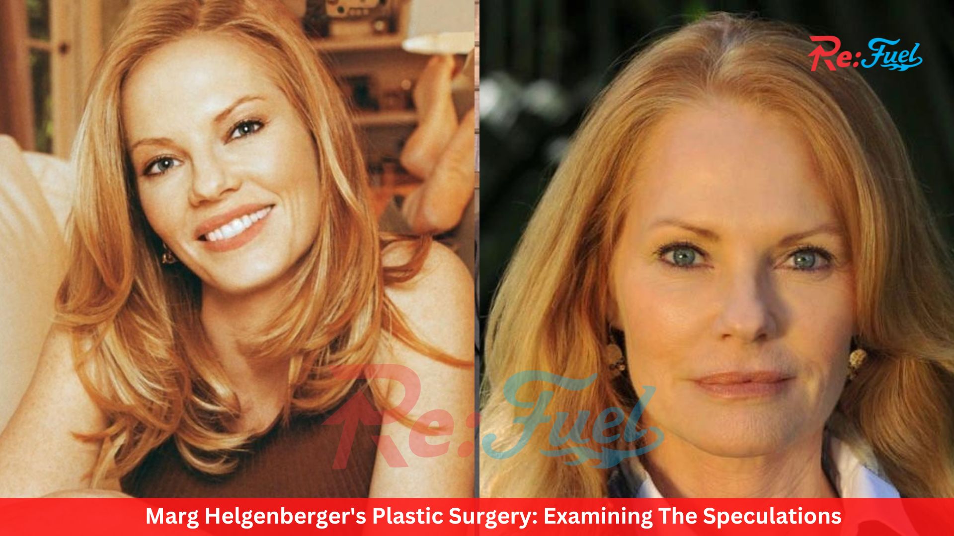Marg Helgenberger's Plastic Surgery: Examining The Speculations