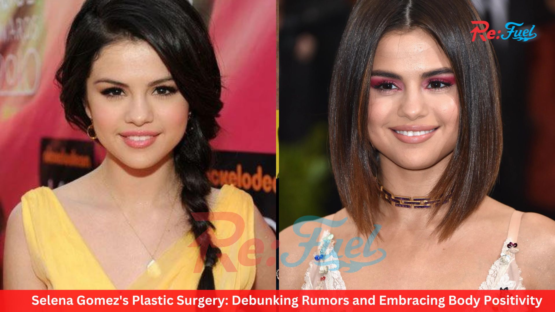 Selena Gomez's Plastic Surgery: Debunking Rumors and Embracing Body Positivity