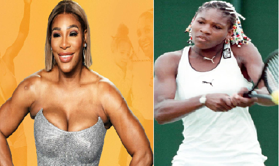 Are Rumors About Serena Williams's Plastic Surgery True?