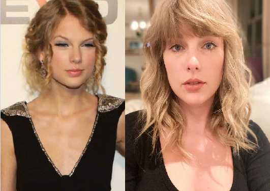 Has Taylor Swift Had Plastic Surgery?