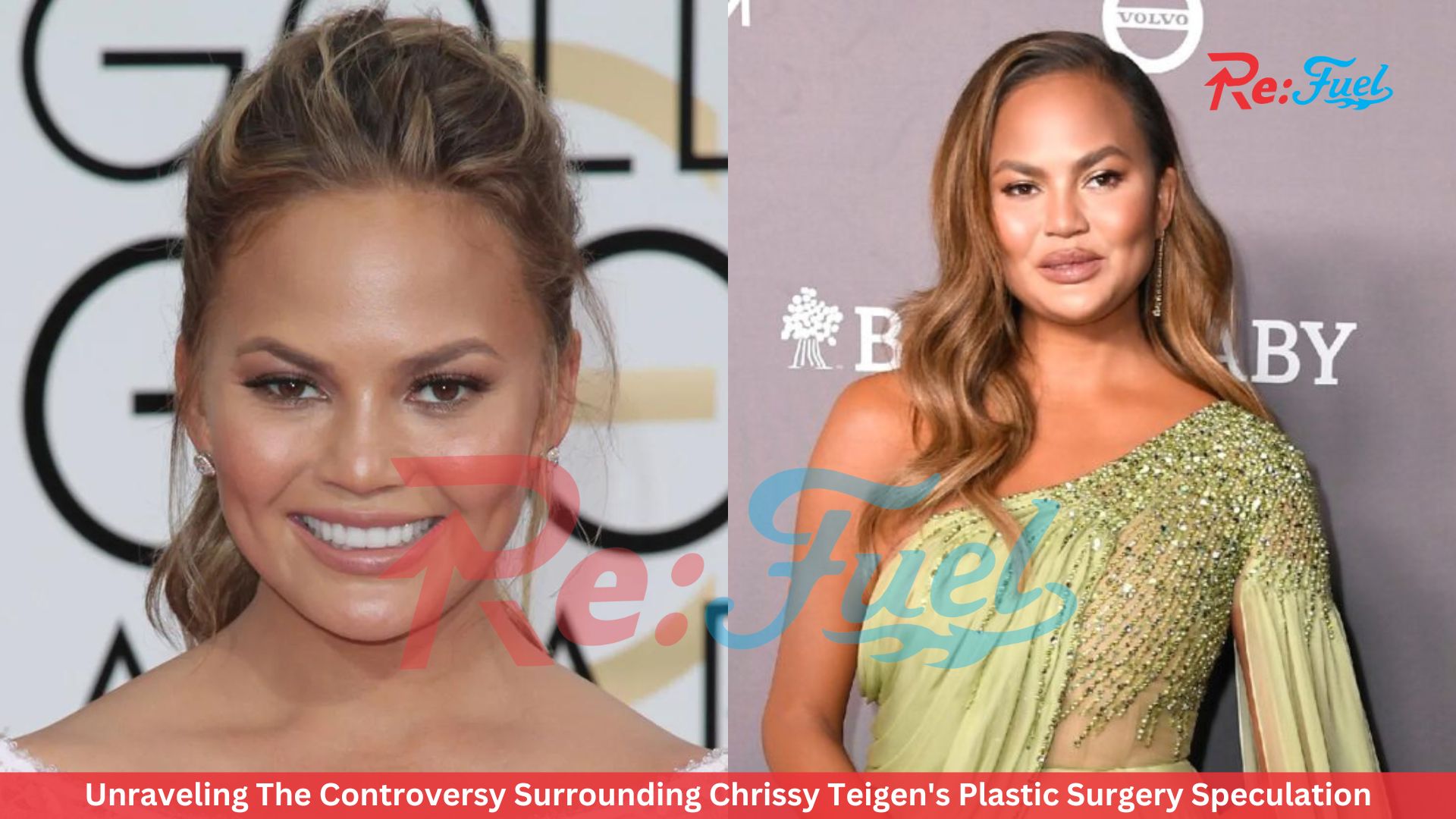 Unraveling The Controversy Surrounding Chrissy Teigen's Plastic Surgery Speculation