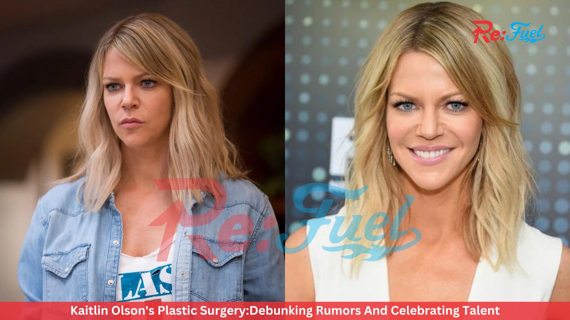 Kaitlin Olson's Plastic Surgery:Debunking Rumors And Celebrating Talent