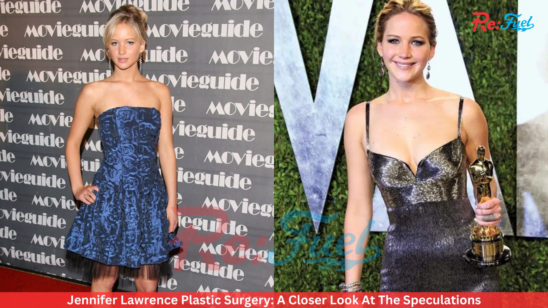 Jennifer Lawrence Plastic Surgery: A Closer Look At The Speculations