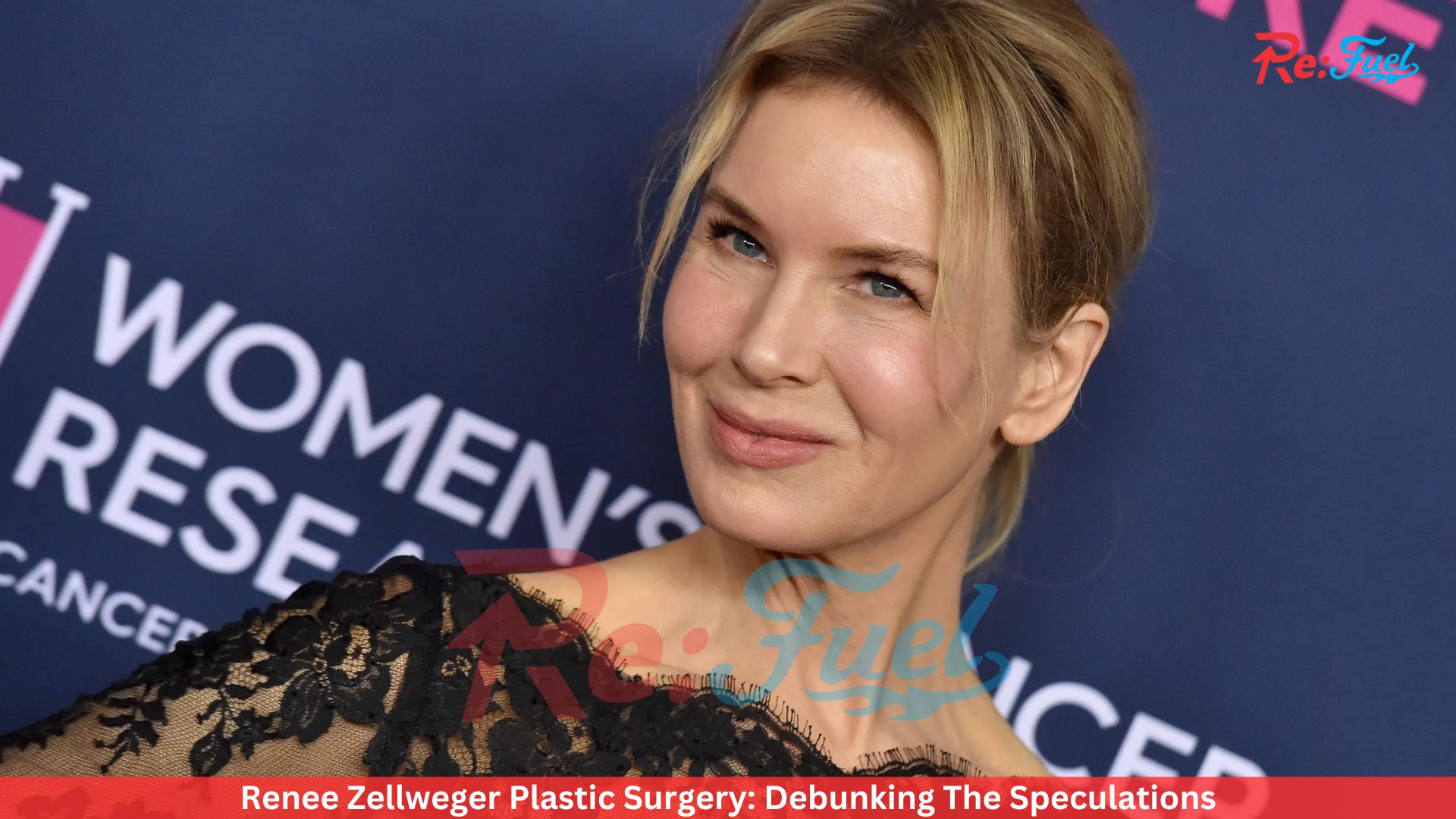 Renee Zellweger Plastic Surgery: Debunking The Speculations