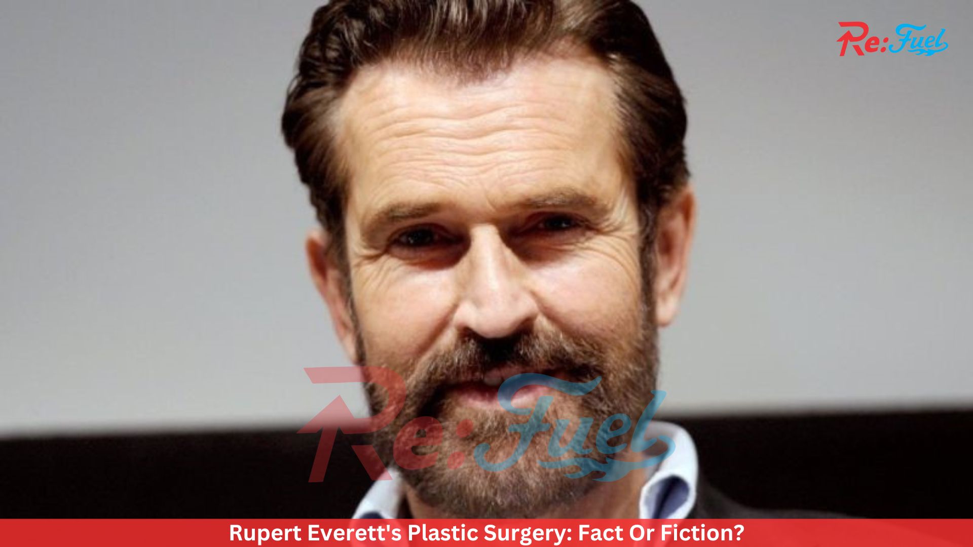 Rupert Everett's Plastic Surgery: Fact Or Fiction?