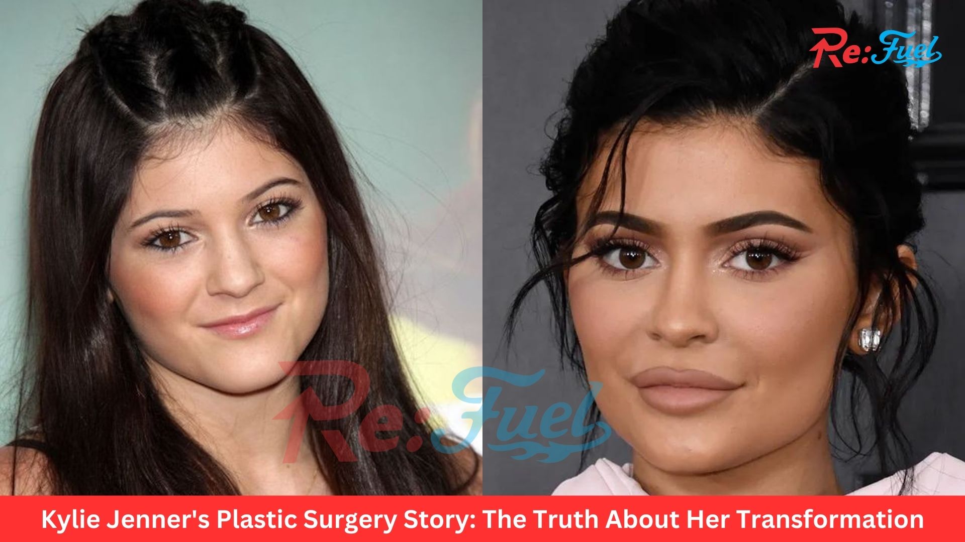 Kylie Jenner's Plastic Surgery Story: The Truth About Her Transformation