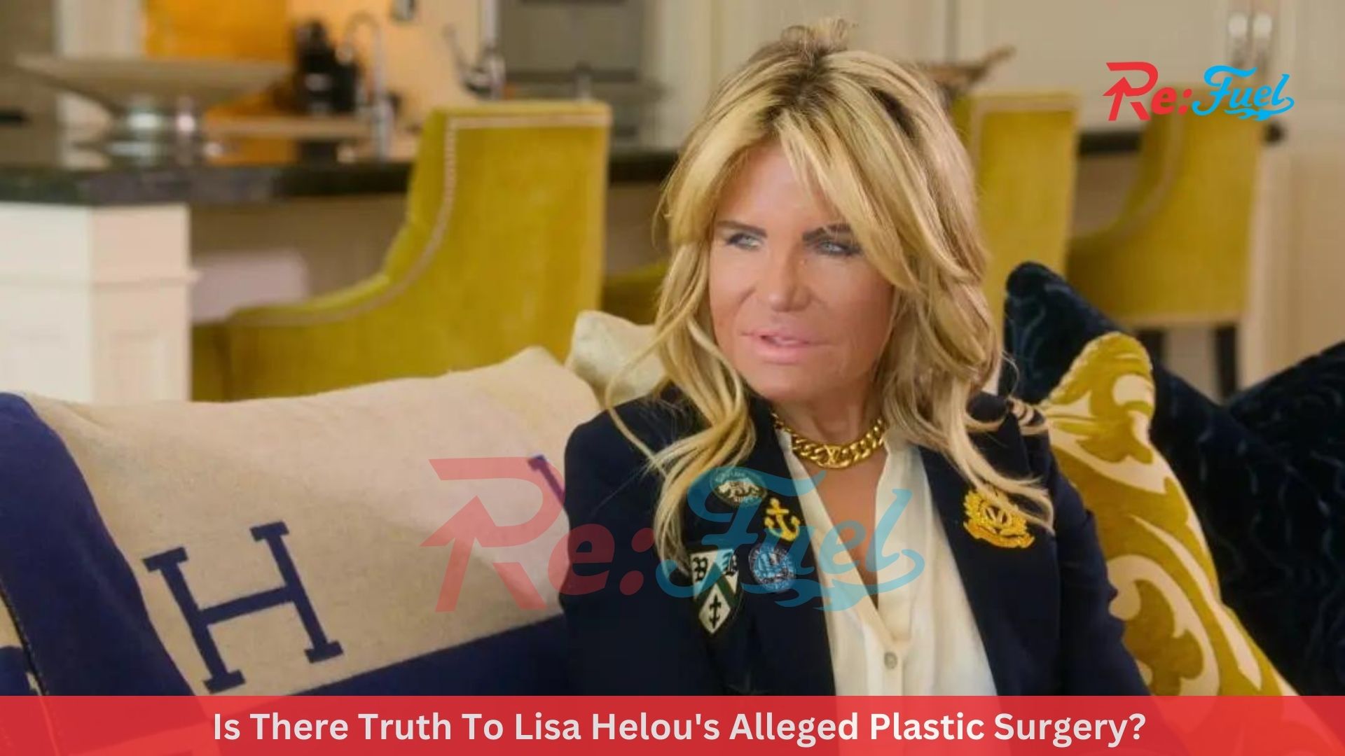 Is There Truth To Lisa Helou's Alleged Plastic Surgery?