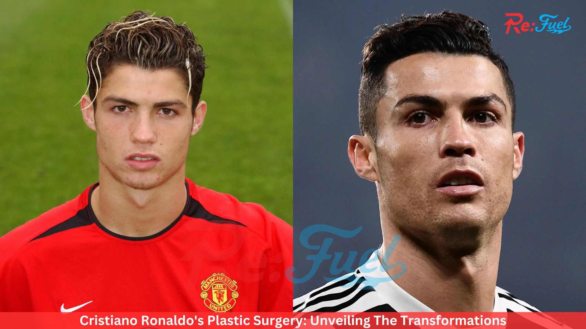 Cristiano Ronaldo's Plastic Surgery: Unveiling The Transformations