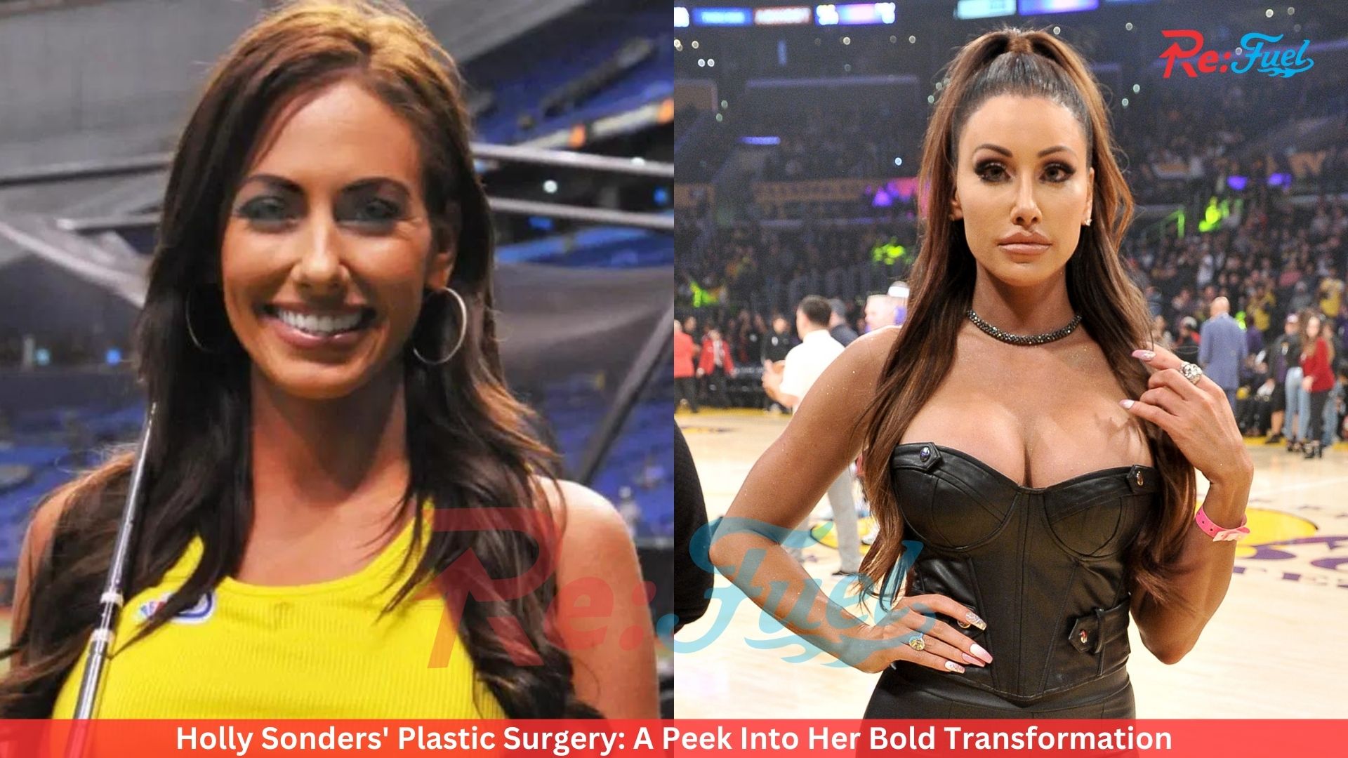 Holly Sonders' Plastic Surgery: A Peek Into Her Bold Transformation
