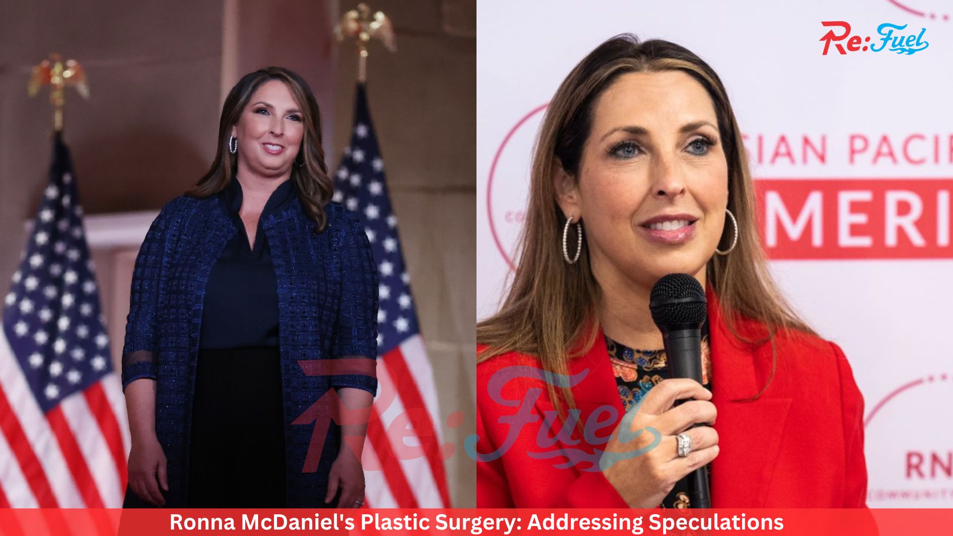 Ronna McDaniel's Plastic Surgery: Addressing Speculations