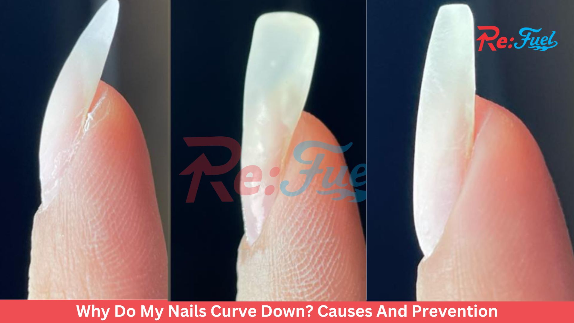 Why Do My Nails Curve Down? Causes And Prevention