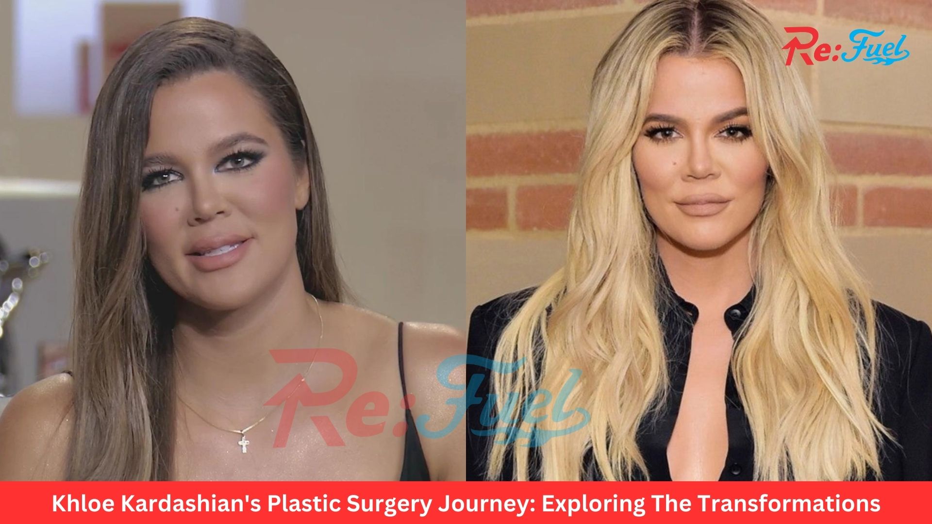 Khloe Kardashian's Plastic Surgery Journey: Exploring The Transformations